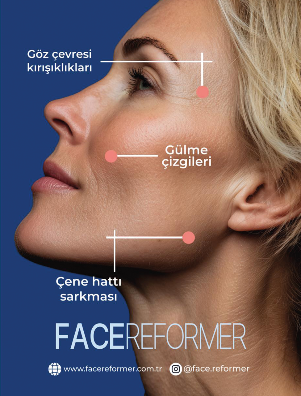 Ameliyatsız Yüz Germe